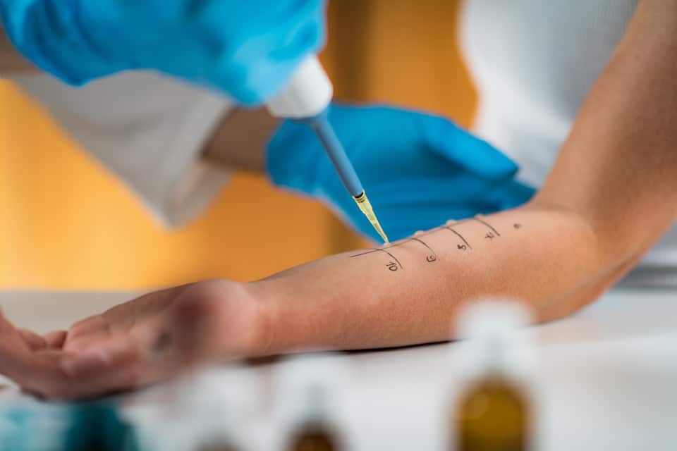allergy-test
