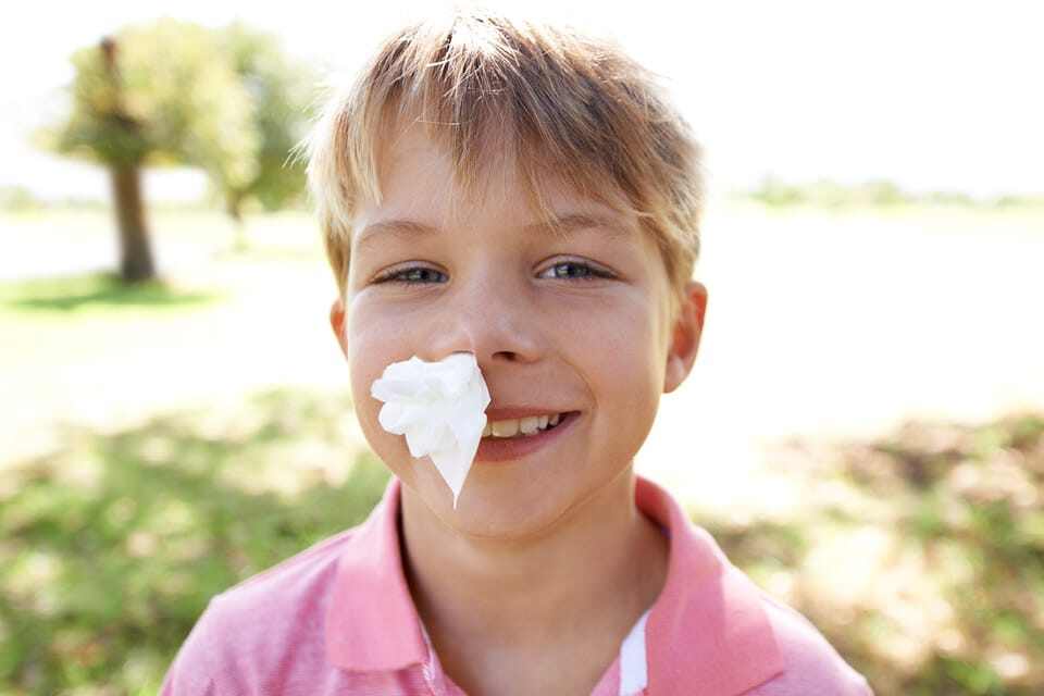 Nose bleed