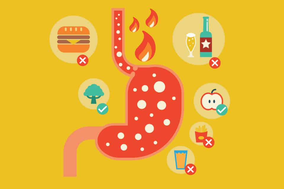 Laryngopharyngeal Reflux