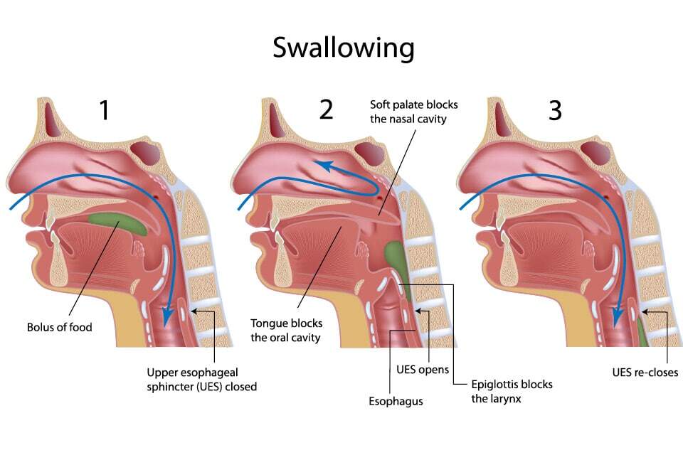 Difficulty Swallowing