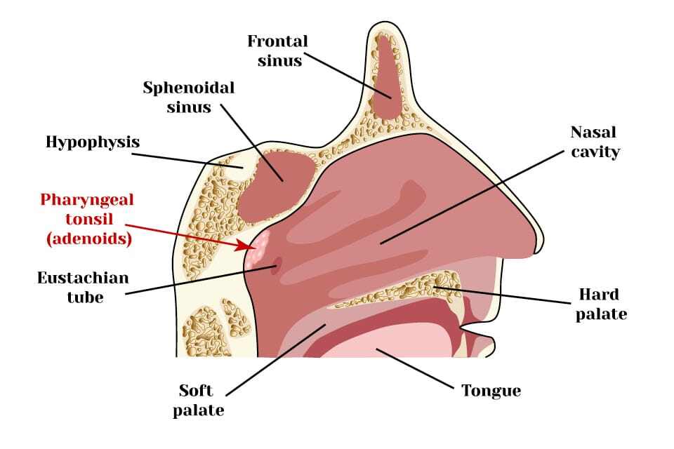 About Face: Preventing Adenoid Faces In Children